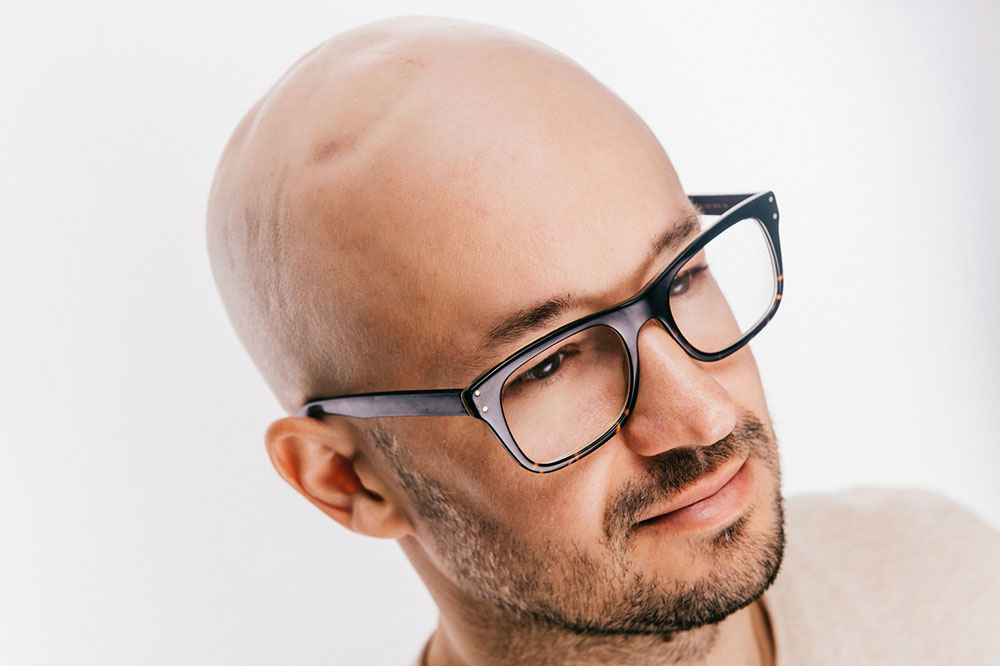 Natural Ways to Treat Male Pattern Baldness